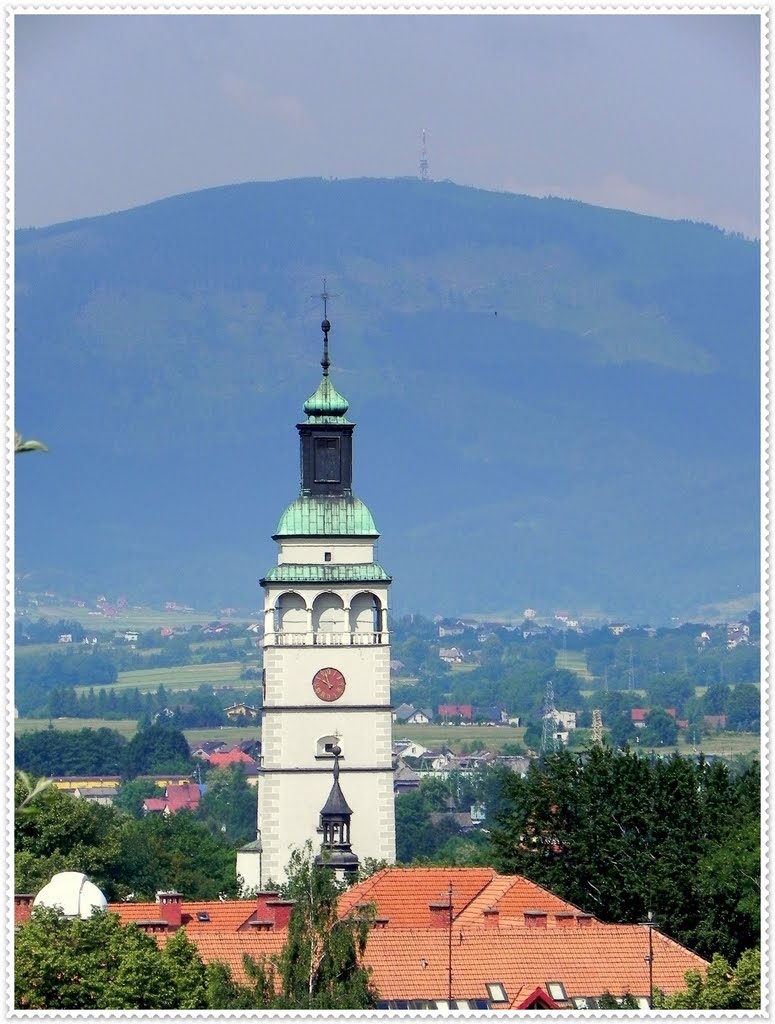 Żywiec - wieża Kontrkatedry
