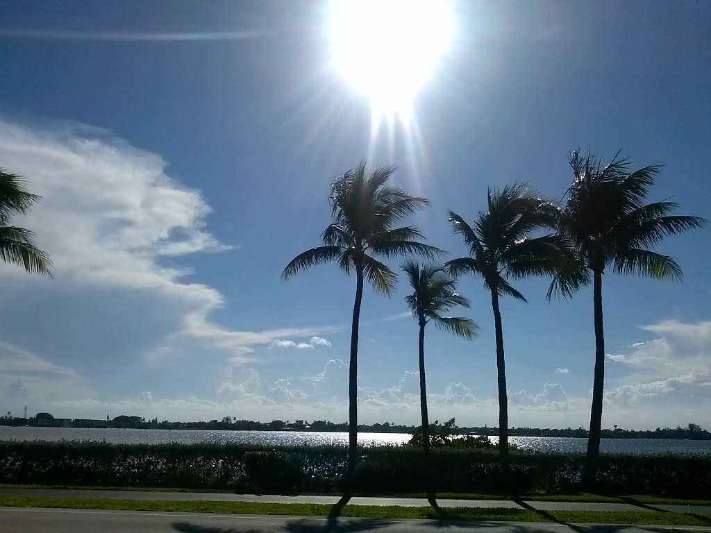 Intercostal