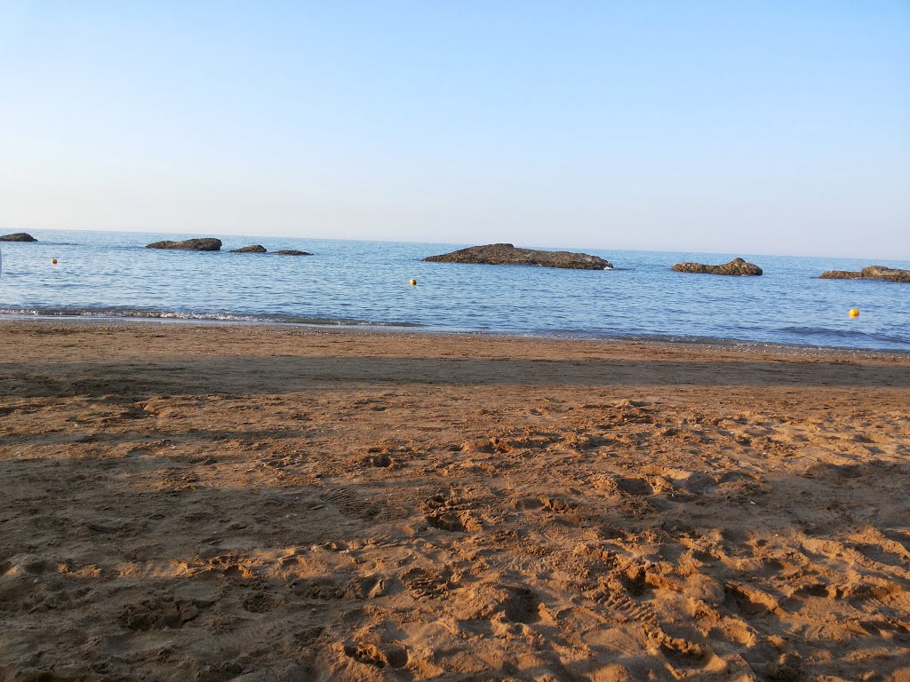 Buzovna