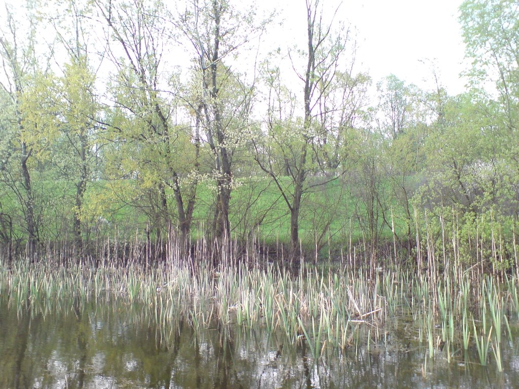 апендицыт